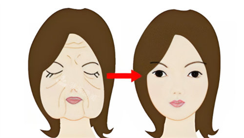 面部抗衰前后对比