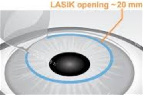 韩国PIND整形前台 韩国PIND整形前台