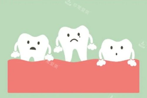 牙齿松动卡通图
