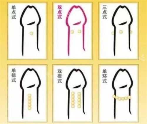 阴茎入珠术款式 阴茎入珠术款式