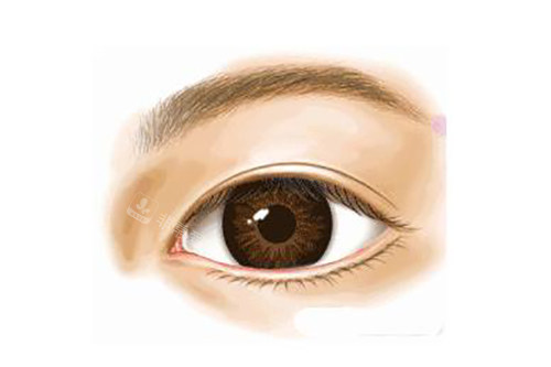 真实双眼皮示意图 真实双眼皮示意图