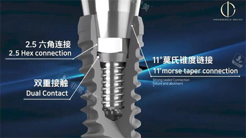 韩一种植牙材料展示照片