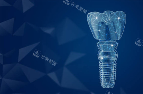 单颗种植牙图