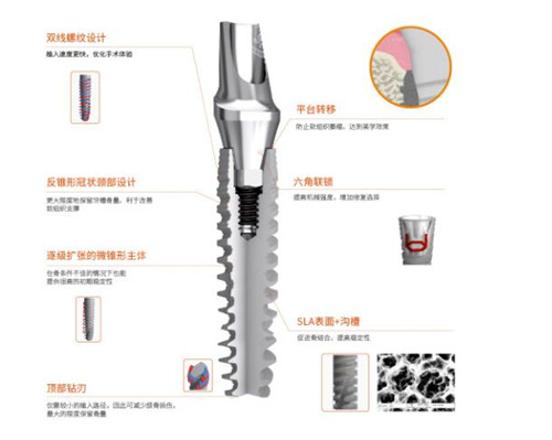 国产百齿泰种植牙优势