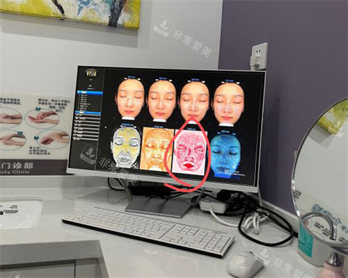 北京三仁医美的面部检前后对比