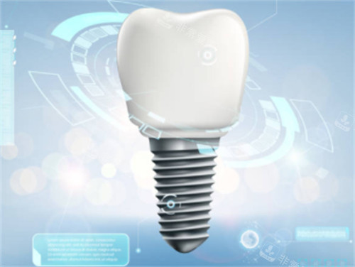 种植牙背景图