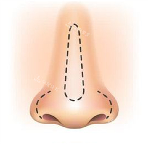 鼻子的卡通绘画图_副本