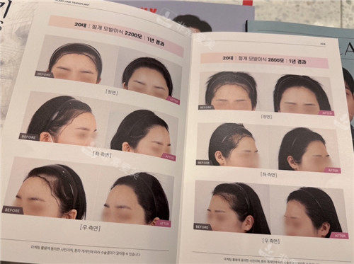 韩国毛茂医院院内图册展示 韩国毛茂医院院内图册展示