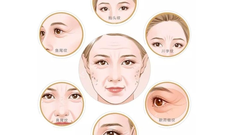 面部细纹部分部位展示图 面部细纹部分部位展示图