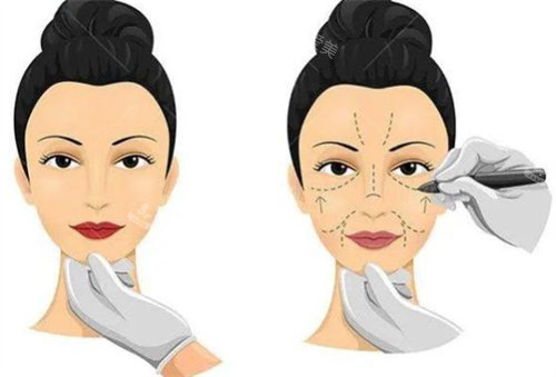 北京加减美穆宝安拉皮技术好的狠，在国内拉皮领域都是备受认可的医生！