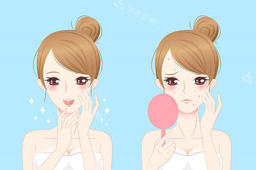 祛痘前后对比卡通示意图 祛痘前后对比卡通示意图