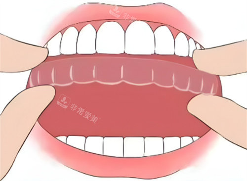 隐形矫正图片展示