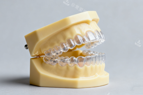 隐形矫正器模型展示图
