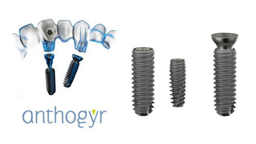 安卓健种植牙修复