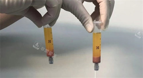 太原做脂肪整形医生哪个好?华晋白慧叶、时光席晓云、欧美莲刘清波均优选!