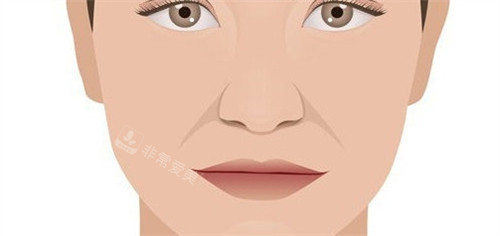 海口会美医疗美容怎么样?是正规连锁医美！热玛吉/钛提升/童颜针等做得好且出名！