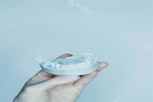 牙齿矫正模型展示