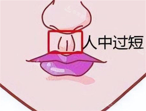 人中过短的样子图片