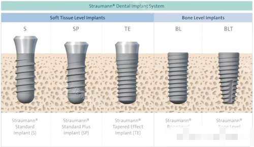 士卓曼软组织水平种植体图片