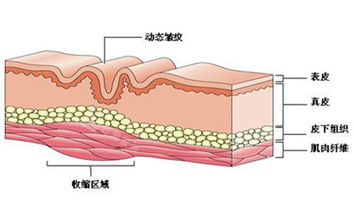皮肤上皱纹的产生 皮肤上皱纹的产生
