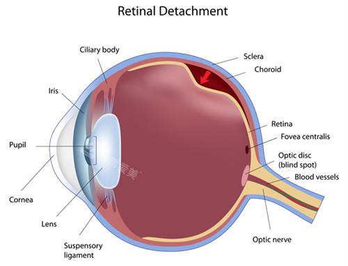 腹部吸脂术前后对比动画图 腹部吸脂术前后对比动画图