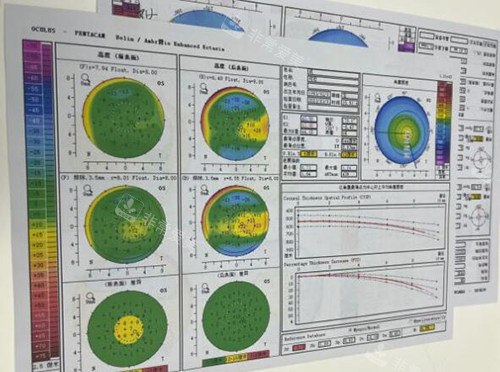 东莞友华普惠眼科近视改善