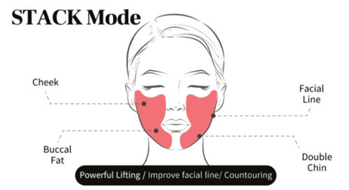 韩国非常流行的钛提升是什么？钛提升和热玛吉、超声提升的区别及价格对比公布！