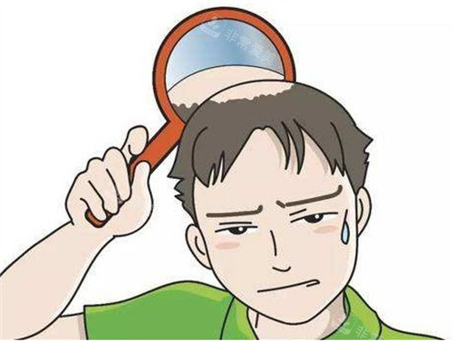 脂溢性脫發(fā)造成的困擾 脂溢性脫發(fā)造成的困擾