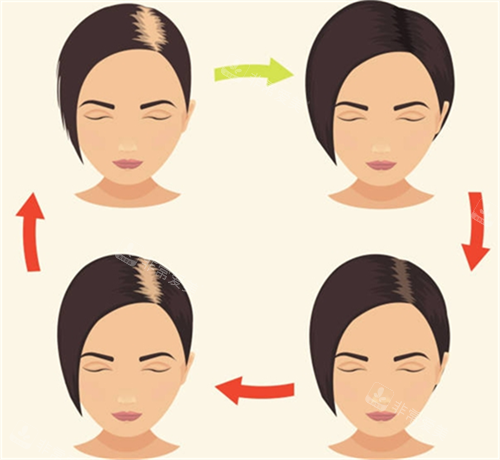 脫發(fā)周期素材 脫發(fā)周期素材