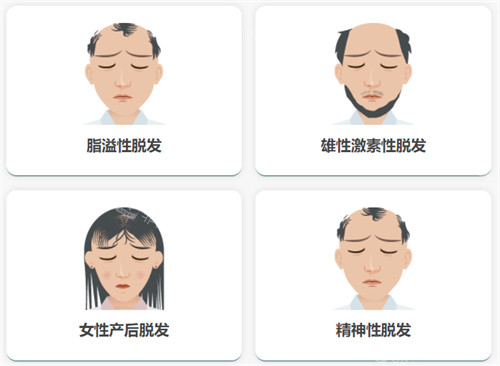 不同脫發(fā)類型 不同脫發(fā)類型