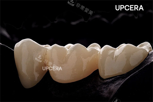 瓷倍健全瓷牙图示