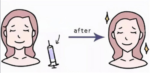 打針瘦臉卡通圖