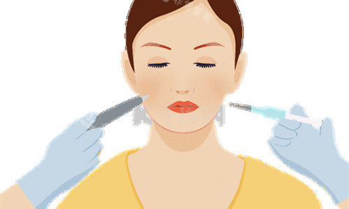 水光注射圖 水光注射圖