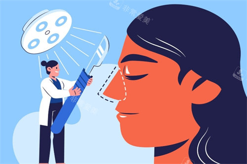 鼻部手术示意图