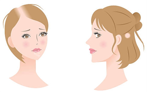 锦州福际植发靠谱吗？松山新区门店，个性化方案适配不同脱发需求