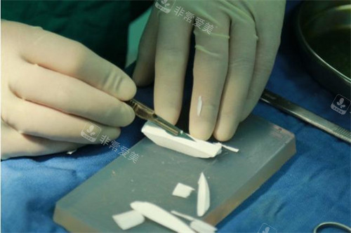 隆鼻手术正在雕刻的膨体