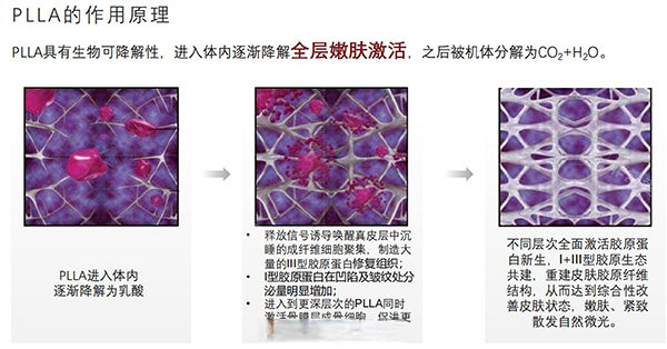 清秀针成分原理照片