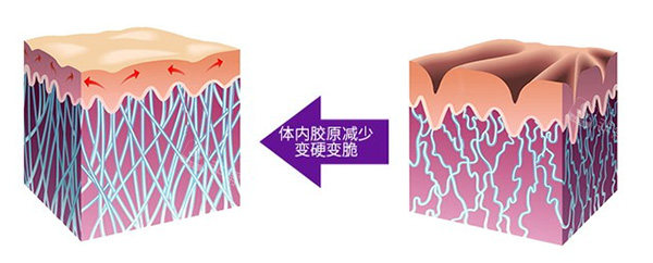 清秀针胶原蛋白示意图