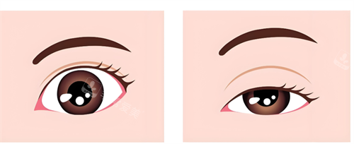 眼睛形态