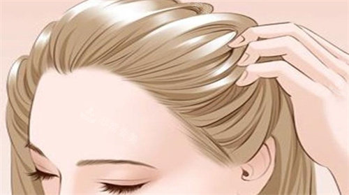 韩国发际线植发真实体验及感受分享，植发结果自然密度均匀/改善顺利满意度高！