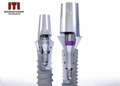 瑞士ITI种植体示意图1