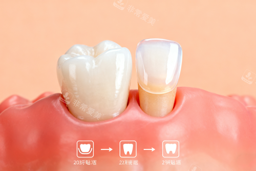 健康牙齿卡通展示图