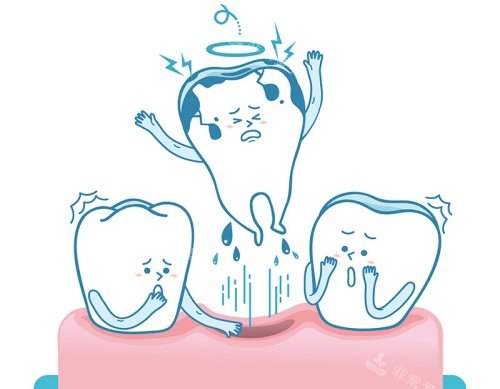 牙齿脱落漫画示意图