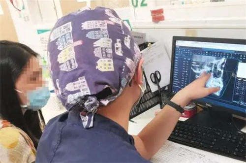 隐形矫正过程医生讲解牙齿情况