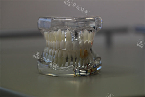 牙齿模型示意图宣传