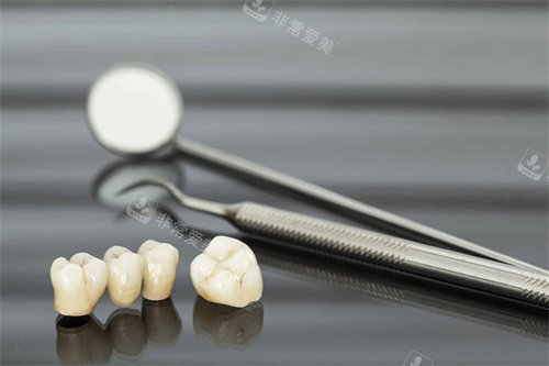 牙齿检查工具和牙冠