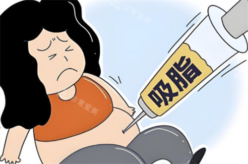 非正規(guī)吸脂術(shù) 非正規(guī)吸脂術(shù)