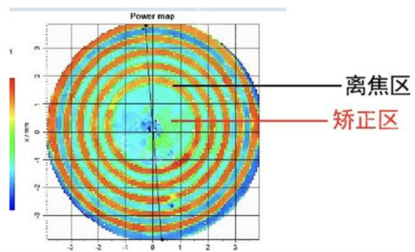 近视配镜前检查图解
