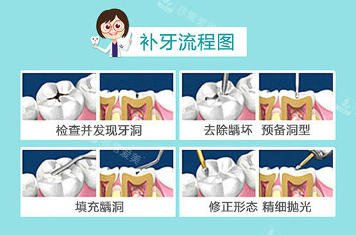 补牙流程图示