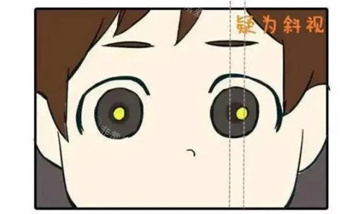 小朋友斜视素材图片